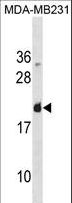 LGALS7 / Galectin 7 Antibody - LGALS7 Antibody western blot of MDA-MB231 cell line lysates (35 ug/lane). The LGALS7 antibody detected the LGALS7 protein (arrow).