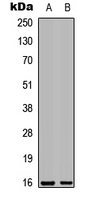 LGALS7 / Galectin 7 Antibody - Western blot analysis of Galectin 7 expression in HEK293T (A); NIH3T3 (B) whole cell lysates.