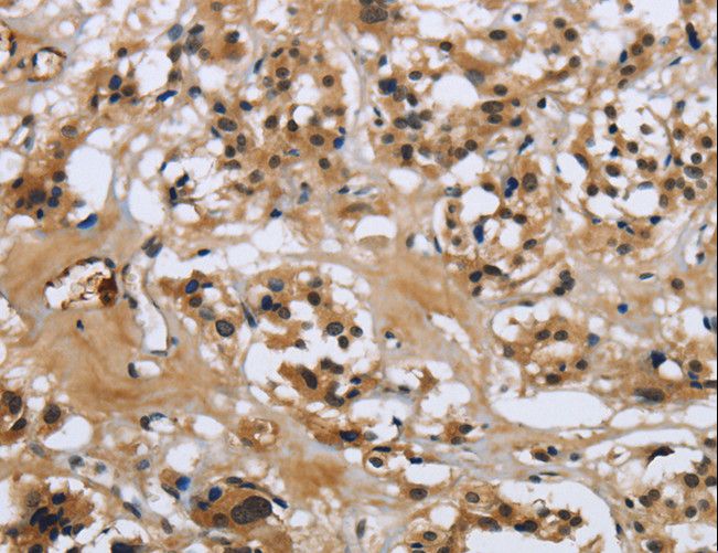 LGALS7 / Galectin 7 Antibody - Immunohistochemistry of paraffin-embedded Human tonsil using LGALS7 Polyclonal Antibody at dilution of 1:50.