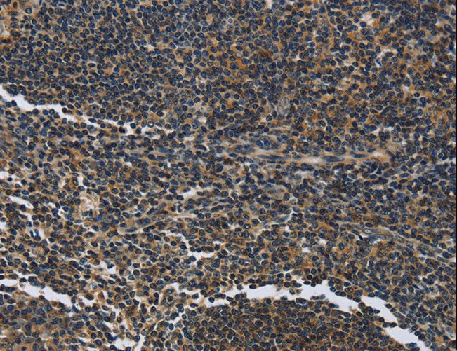 LGALS7 / Galectin 7 Antibody - Immunohistochemistry of paraffin-embedded Human tonsil using LGALS7 Polyclonal Antibody at dilution of 1:50.