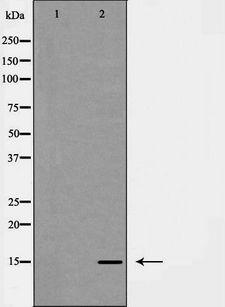 LGALS7 / Galectin 7 Antibody - Western blot analysis of LEG7 expression in HeLa cells. The lane on the left is treated with the antigen-specific peptide.