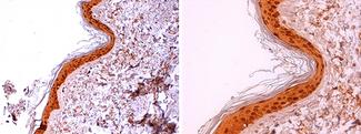 LGALS7 / Galectin 7 Antibody - Anti-Human Galectin-7 staining (4 µg/ml) of a human skin formalin-fixed, paraffin-embedded tissue section; seen at 20x (left) and 40x (right) magnification. Nuclear and cytoplasmic staining of keratinocytes is observed.
