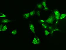 LGALS7 / Galectin 7 Antibody - Immunofluorescence staining of LGALS7 in A431 cells. Cells were fixed with 4% PFA, permeabilzed with 0.3% Triton X-100 in PBS, blocked with 10% serum, and incubated with rabbit anti-Human LGALS7 polyclonal antibody (dilution ratio 1:5000) at 4°C overnight. Then cells were stained with the Alexa Fluor 488-conjugated Goat Anti-rabbit IgG secondary antibody (green). Positive staining was localized to cytoplasm and nucleus.