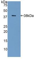 LGALS8 / Galectin 8 Antibody - Western Blot; Sample: Recombinant GAL8, Human.