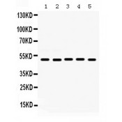LGALS8 / Galectin 8 Antibody - Galectin 8 antibody Western blot. All lanes: Anti Galectin 8 at 0.5 ug/ml. Lane 1: Rat Brain Tissue Lysate at 50 ug. Lane 2: Rat Kidney Tissue Lysate at 50 ug. Lane 3: Human Placenta Tissue Lysate at 50 ug. Lane 4: HELA Whole Cell Lysate at 40 ug. Lane 5: A431 Whole Cell Lysate at 40 ug. Predicted band size: 36 kD. Observed band size: 50 kD.