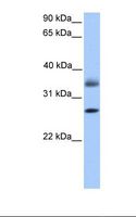LGALS8 / Galectin 8 Antibody - Hela cell lysate. Antibody concentration: 1.0 ug/ml. Gel concentration: 12%.  This image was taken for the unconjugated form of this product. Other forms have not been tested.