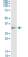 LGALS8 / Galectin 8 Antibody - LGALS8 monoclonal antibody (M01), clone 3E5. Western Blot analysis of LGALS8 expression in Raw 264.7.