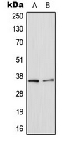 LGALS8 / Galectin 8 Antibody - Western blot analysis of Galectin 8 expression in HepG2 (A); NIH3T3 (B) whole cell lysates.