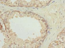 LGALS8 / Galectin 8 Antibody - Immunohistochemistry of paraffin-embedded human prostate tissue at dilution 1:100