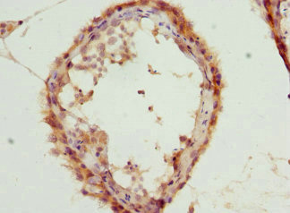 LGALS8 / Galectin 8 Antibody - Immunohistochemistry of paraffin-embedded human testis tissue at dilution 1:100