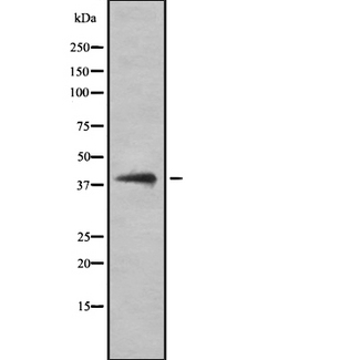 LGALS8 / Galectin 8 Antibody - Western blot analysis of LGALS8 using A549 whole cells lysates
