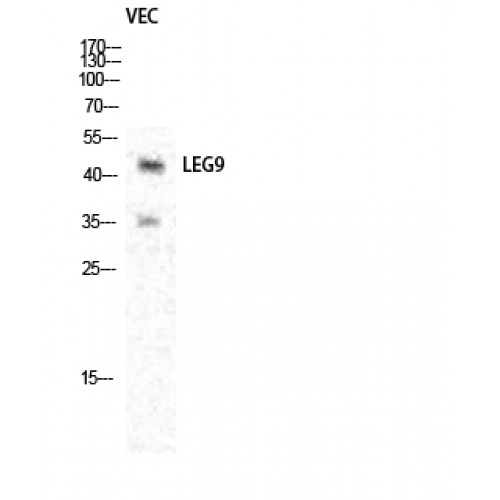LGALS9 / Galectin 9 Antibody - Western blot of Galectin-9 antibody