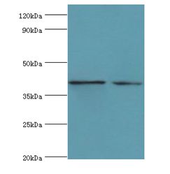 LGALS9 / Galectin 9 Antibody - Western blot. All lanes: LGALS9 antibody at 14 ug/ml. Lane 1: HeLa whole cell lysate. Lane 2: Jurkat whole cell lysate. Secondary antibody: Goat polyclonal to rabbit at 1:10000 dilution. Predicted band size: 40 kDa. Observed band size: 40 kDa.