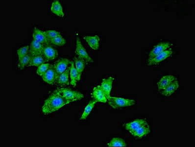 LGALS9 / Galectin 9 Antibody - Immunofluorescent analysis of HepG2 cells using LGALS9 Antibody at dilution of 1:100 and Alexa Fluor 488-congugated AffiniPure Goat Anti-Rabbit IgG(H+L)