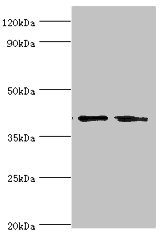LGALS9 / Galectin 9 Antibody - Western blot All lanes: LGALS9 antibody at 14µg/ml Lane 1: Hela whole cell lysate Lane 2: Jurkat whole cell lysate Secondary Goat polyclonal to rabbit IgG at 1/10000 dilution Predicted band size: 40, 36, 35, 27, 26, 39 kDa Observed band size: 40 kDa