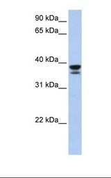 LGALS9 / Galectin 9 Antibody - Fetal muscle lysate. Antibody concentration: 1.0 ug/ml. Gel concentration: 12%.  This image was taken for the unconjugated form of this product. Other forms have not been tested.