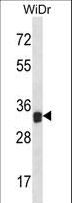 LGALS9 / Galectin 9 Antibody - LGALS9 Antibody western blot of WiDr cell line lysates (35 ug/lane). The LGALS9 antibody detected the LGALS9 protein (arrow).