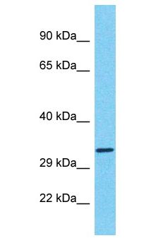 LGALS9 / Galectin 9 Antibody - LGALS9 / Galectin 9 antibody Western Blot of HCT15. Antibody dilution: 1 ug/ml.  This image was taken for the unconjugated form of this product. Other forms have not been tested.