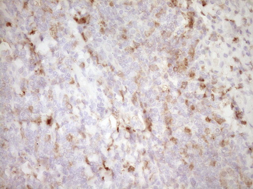 LGALS9 / Galectin 9 Antibody - Immunohistochemical staining of paraffin-embedded Human tonsil within the normal limits using anti-LGALS9 mouse monoclonal antibody. (Heat-induced epitope retrieval by Tris-EDTA, pH8.0) Dilution: 1:150