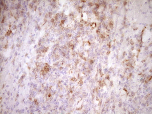 LGALS9 / Galectin 9 Antibody - Immunohistochemical staining of paraffin-embedded Human colon tissue within the normal limits using anti-LGALS9 mouse monoclonal antibody. (Heat-induced epitope retrieval by Tris-EDTA, pH8.0) Dilution: 1:150