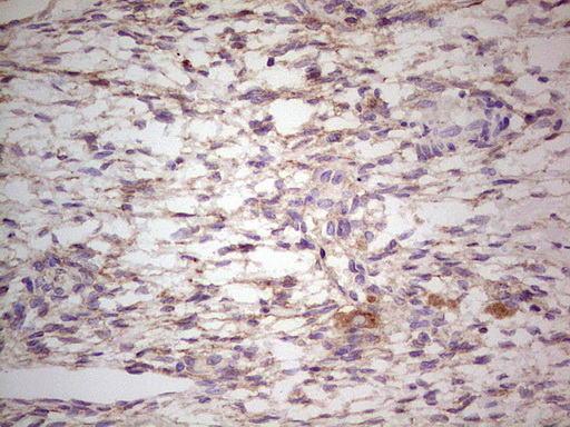 LGALS9 / Galectin 9 Antibody - Immunohistochemical staining of paraffin-embedded Human Ovary tissue within the normal limits using anti-LGALS9 mouse monoclonal antibody. (Heat-induced epitope retrieval by 1 mM EDTA in 10mM Tris, pH8.5, 120C for 3min,
