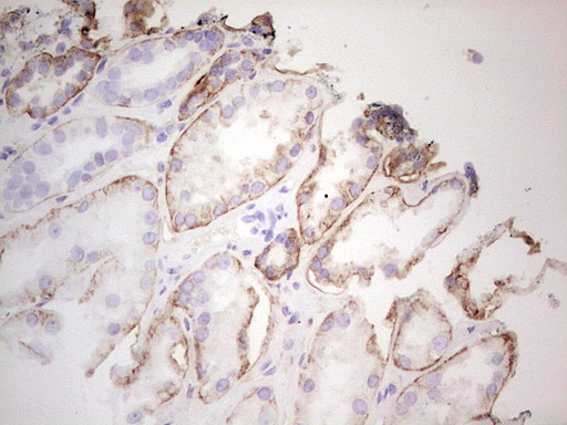 LGALS9 / Galectin 9 Antibody - Immunohistochemical staining of paraffin-embedded Human Kidney tissue within the normal limits using anti-LGALS9 mouse monoclonal antibody. (Heat-induced epitope retrieval by 1 mM EDTA in 10mM Tris, pH8.5, 120C for 3min,