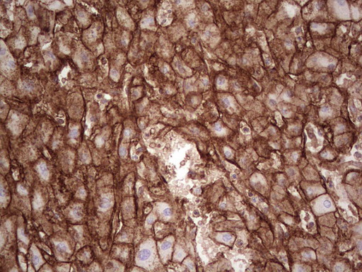 LGALS9 / Galectin 9 Antibody - Immunohistochemical staining of paraffin-embedded Human liver tissue within the normal limits using anti-LGALS9 mouse monoclonal antibody. (Heat-induced epitope retrieval by 1 mM EDTA in 10mM Tris, pH8.5, 120C for 3min,