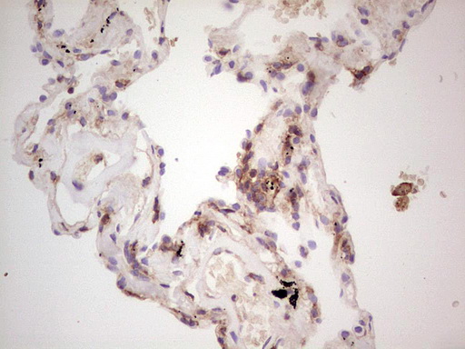 LGALS9 / Galectin 9 Antibody - Immunohistochemical staining of paraffin-embedded Human lung tissue within the normal limits using anti-LGALS9 mouse monoclonal antibody. (Heat-induced epitope retrieval by 1 mM EDTA in 10mM Tris, pH8.5, 120C for 3min,