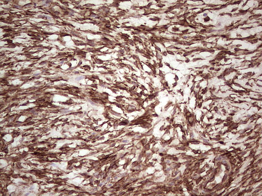 LGALS9 / Galectin 9 Antibody - Immunohistochemical staining of paraffin-embedded Human Ovary tissue within the normal limits using anti-LGALS9 mouse monoclonal antibody. (Heat-induced epitope retrieval by 1 mM EDTA in 10mM Tris, pH8.5, 120C for 3min,