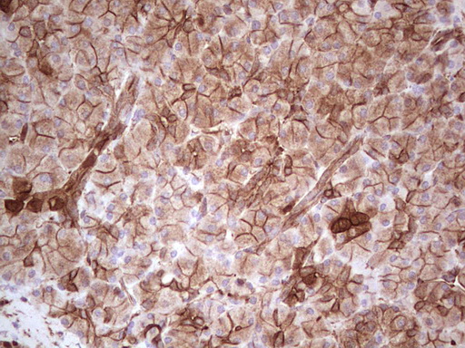 LGALS9 / Galectin 9 Antibody - Immunohistochemical staining of paraffin-embedded Human pancreas tissue within the normal limits using anti-LGALS9 mouse monoclonal antibody. (Heat-induced epitope retrieval by 1 mM EDTA in 10mM Tris, pH8.5, 120C for 3min,