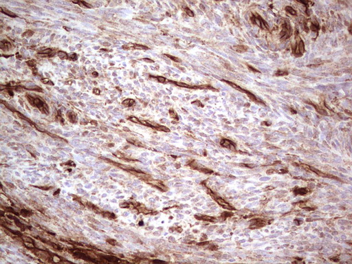 LGALS9 / Galectin 9 Antibody - Immunohistochemical staining of paraffin-embedded Human endometrium tissue within the normal limits using anti-LGALS9 mouse monoclonal antibody. (Heat-induced epitope retrieval by 1 mM EDTA in 10mM Tris, pH8.5, 120C for 3min,