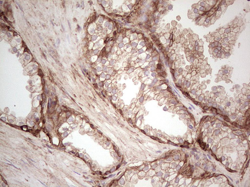 LGALS9 / Galectin 9 Antibody - Immunohistochemical staining of paraffin-embedded Human prostate tissue within the normal limits using anti-LGALS9 mouse monoclonal antibody. (Heat-induced epitope retrieval by 1 mM EDTA in 10mM Tris, pH8.5, 120C for 3min,