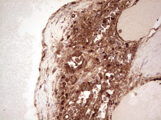 LGALS9 / Galectin 9 Antibody - Immunohistochemical staining of paraffin-embedded Human lymph node tissue within the normal limits using anti-LGALS9 mouse monoclonal antibody. (Heat-induced epitope retrieval by 1 mM EDTA in 10mM Tris, pH8.5, 120C for 3min,