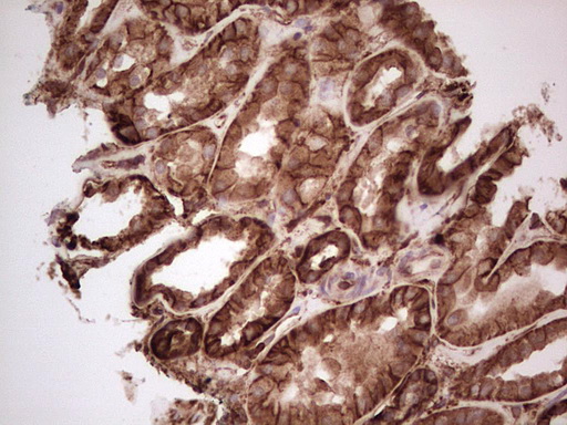 LGALS9 / Galectin 9 Antibody - Immunohistochemical staining of paraffin-embedded Human Kidney tissue within the normal limits using anti-LGALS9 mouse monoclonal antibody. (Heat-induced epitope retrieval by 1 mM EDTA in 10mM Tris, pH8.5, 120C for 3min,