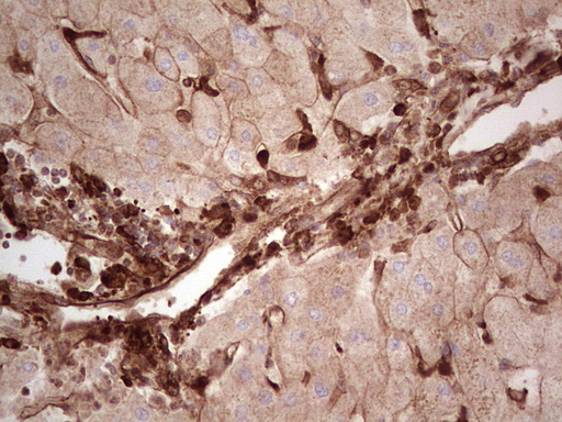 LGALS9 / Galectin 9 Antibody - Immunohistochemical staining of paraffin-embedded Human liver tissue within the normal limits using anti-LGALS9 mouse monoclonal antibody. (Heat-induced epitope retrieval by 1 mM EDTA in 10mM Tris, pH8.5, 120C for 3min,