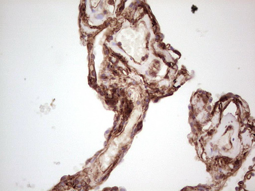LGALS9 / Galectin 9 Antibody - IHC of paraffin-embedded Human lung tissue using anti-LGALS9 mouse monoclonal antibody. (Heat-induced epitope retrieval by 1 mM EDTA in 10mM Tris, pH8.5, 120°C for 3min).