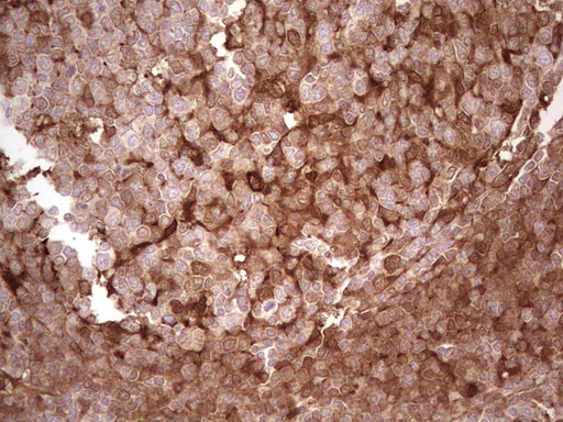 LGALS9 / Galectin 9 Antibody - IHC of paraffin-embedded Human tonsil using anti-LGALS9 mouse monoclonal antibody. (Heat-induced epitope retrieval by 1 mM EDTA in 10mM Tris, pH8.5, 120°C for 3min).