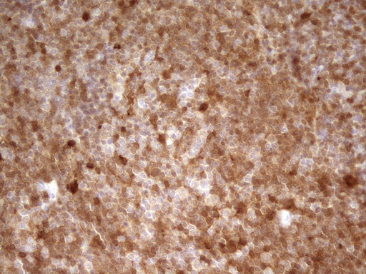 LGALS9 / Galectin 9 Antibody - Immunohistochemical staining of paraffin-embedded Human lymph node tissue within the normal limits using anti-LGALS9 mouse monoclonal antibody. (Heat-induced epitope retrieval by 1 mM EDTA in 10mM Tris, pH8.5, 120C for 3min,