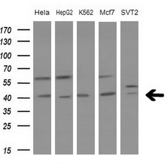 LGALS9 / Galectin 9 Antibody - Western blot analysis of extracts. (10ug) from 5 different cell lines by using anti-LGALS9 monoclonal antibody at 1:200 dilution.
