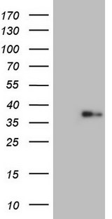 LGALS9 / Galectin 9 Antibody - HEK293T cells were transfected with the pCMV6-ENTRY control (Left lane) or pCMV6-ENTRY LGALS9 (Right lane) cDNA for 48 hrs and lysed. Equivalent amounts of cell lysates (5 ug per lane) were separated by SDS-PAGE and immunoblotted with anti-LGALS9.