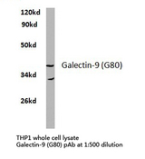 LGALS9 / Galectin 9 Antibody - Western blot of Galectin-9 (G80) pAb in extracts from THP1 cells.
