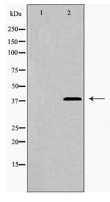 LGALS9 / Galectin 9 Antibody - Western blot of LEG9 expression in HepG2 cells