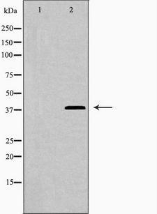 LGALS9 / Galectin 9 Antibody - Western blot analysis of LEG9 expression in HepG2 cells. The lane on the left is treated with the antigen-specific peptide.