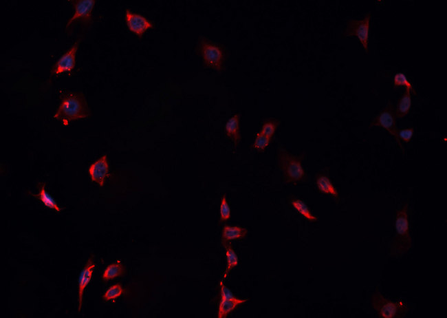LGALS9 / Galectin 9 Antibody - Staining HepG2 cells by IF/ICC. The samples were fixed with PFA and permeabilized in 0.1% Triton X-100, then blocked in 10% serum for 45 min at 25°C. The primary antibody was diluted at 1:200 and incubated with the sample for 1 hour at 37°C. An Alexa Fluor 594 conjugated goat anti-rabbit IgG (H+L) Ab, diluted at 1/600, was used as the secondary antibody.