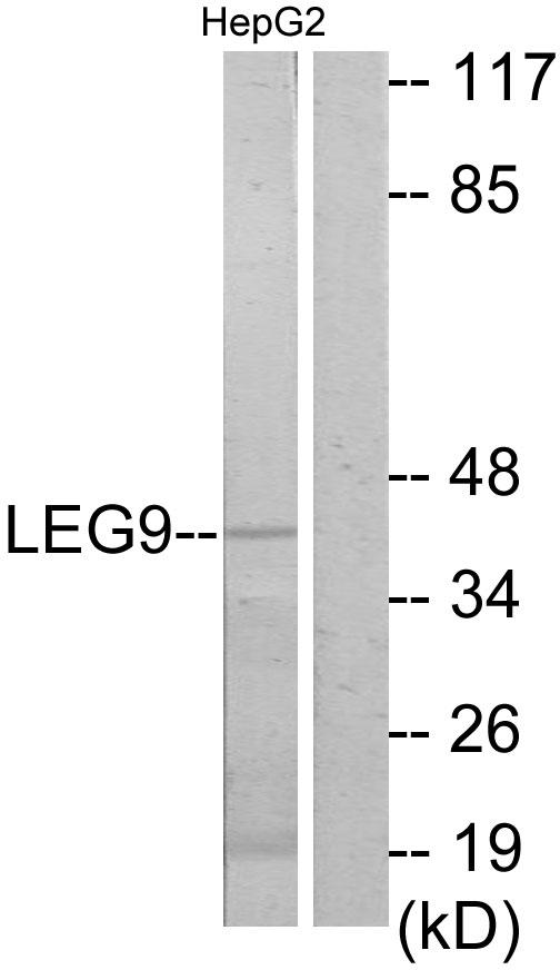 LGALS9 / Galectin 9 Antibody - Western blot analysis of extracts from HepG2 cells, using LEG9 antibody.