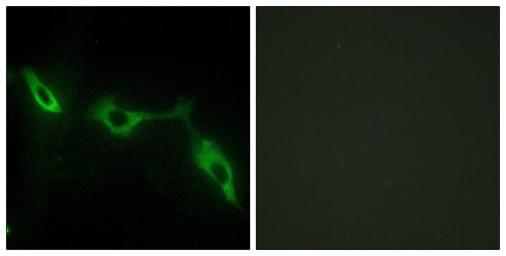 LGALS9 / Galectin 9 Antibody - Peptide - + Immunofluorescence analysis of NIH/3T3 cells, using LEG9 antibody.