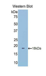 LGALS9B Antibody - Western blot of recombinant LGALS9B.  This image was taken for the unconjugated form of this product. Other forms have not been tested.