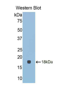 LGALS9C Antibody - Western blot of recombinant LGALS9C.  This image was taken for the unconjugated form of this product. Other forms have not been tested.