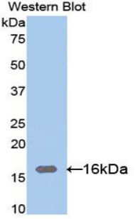 LGALS9C Antibody - Western blot of recombinant LGALS9C.  This image was taken for the unconjugated form of this product. Other forms have not been tested.