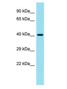 LGALS9C Antibody - LGALS9C antibody Western Blot of HeLa. Antibody dilution: 1 ug/ml.  This image was taken for the unconjugated form of this product. Other forms have not been tested.